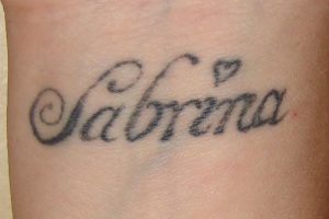 Laser-Tattooentfernung - Tätowierung Handgelenk (Innenseite) vor der Behandlung
