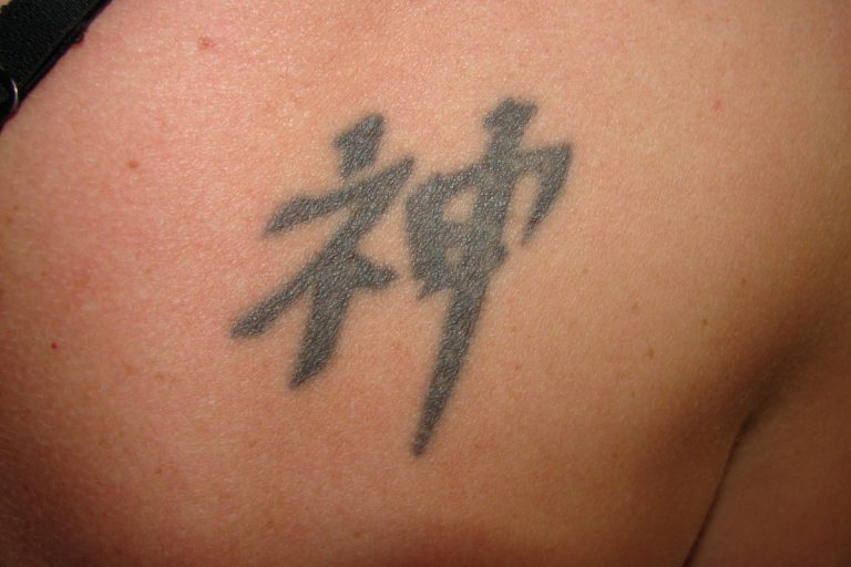 Schulter-Tattoo vor der Behandlung