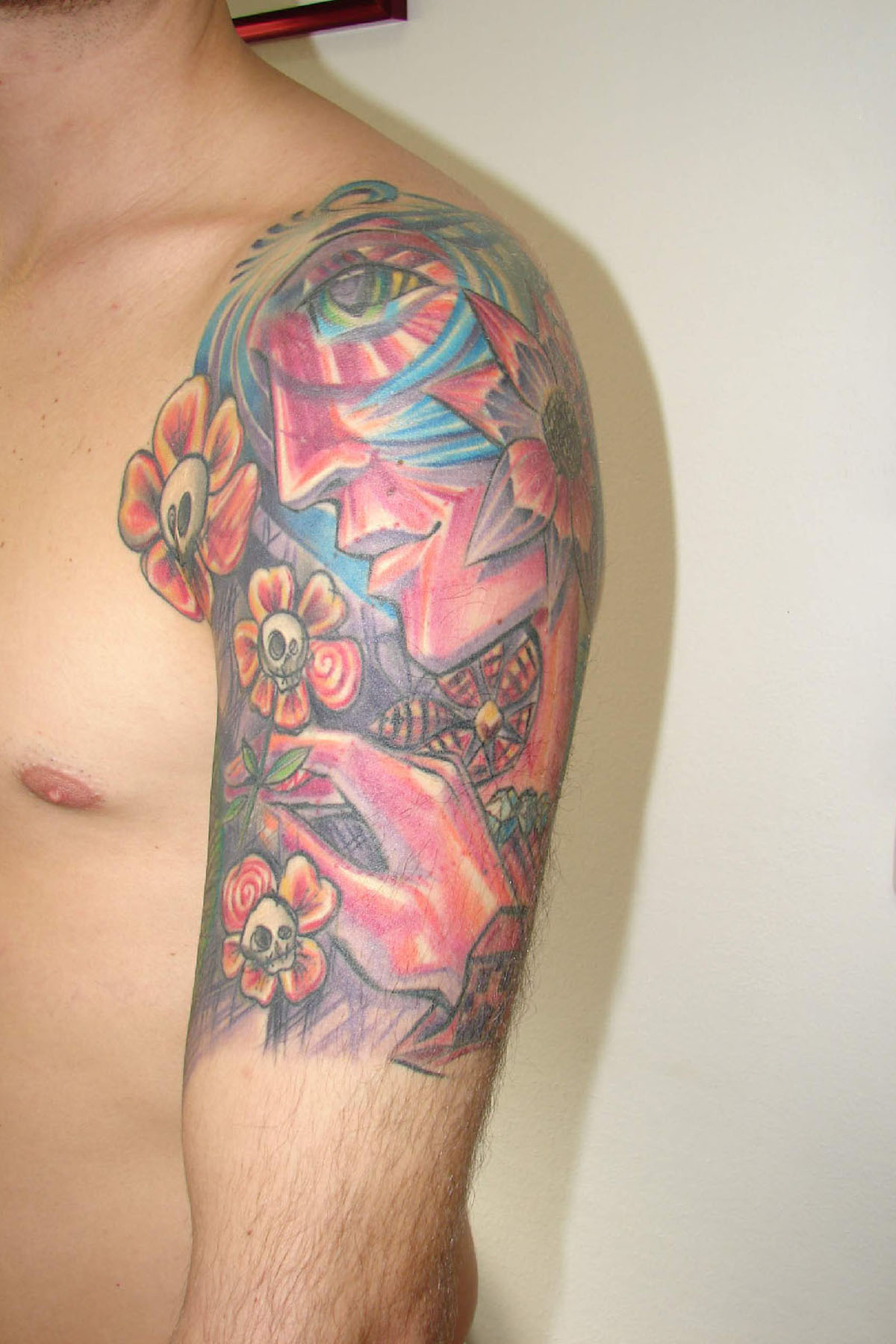 Tattooentfernung eines bunten Tattoos am Oberarm vor der Behandlung