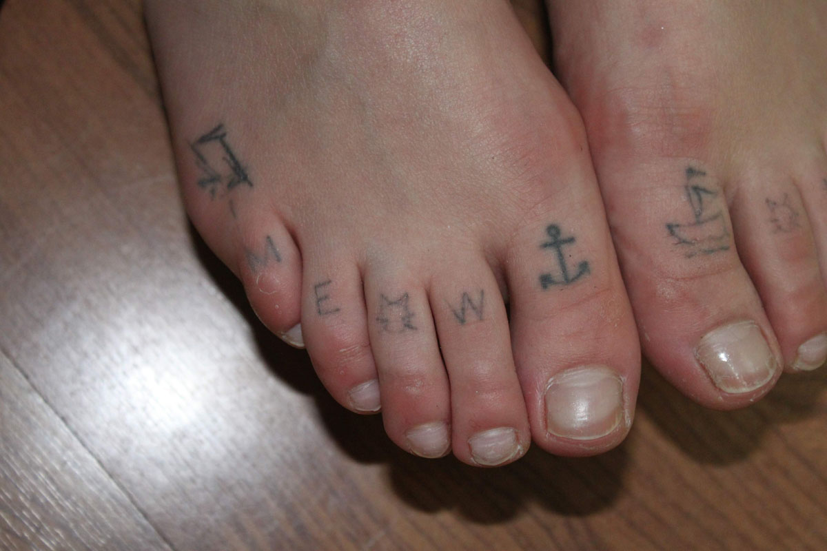 Tattooentfernung auf Zehen vor der Behandlung